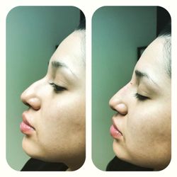 Beautifully Made - 10 minutes nose job!