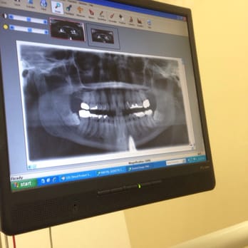 Promenade Dental Group - My X-ray - General Dentistry Near Me - Sacramento, California