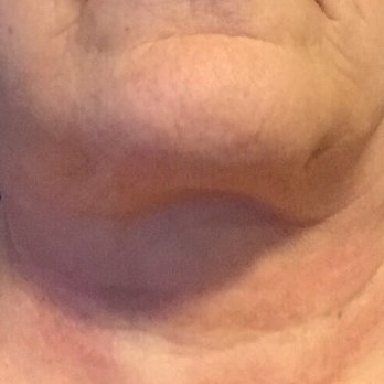 Terry Dubrow, M.D - Cosmetic Surgeons Near Me - Newport Beach, California Terry Dubrow, M.D - Cosmetic Surgeons Near Me - Newport Beach, California