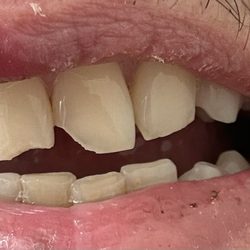 Comfort Dental - Downtown Denver - Before