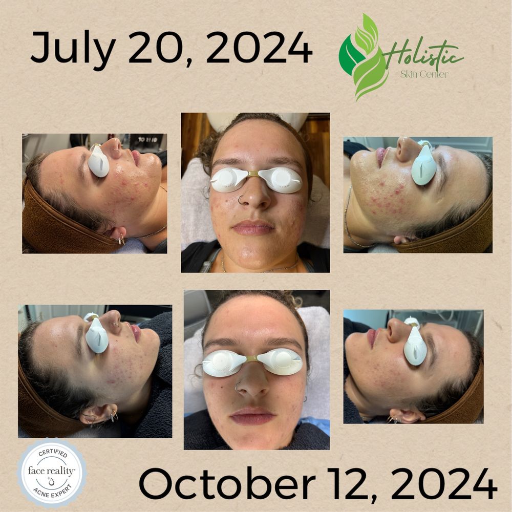 Holistic Skin Center Logo