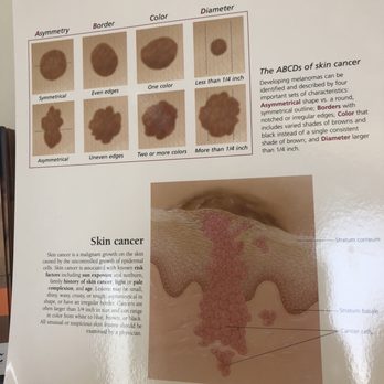 Team Dermatology - Info poster - Dermatologists Near Me - Houston, Texas