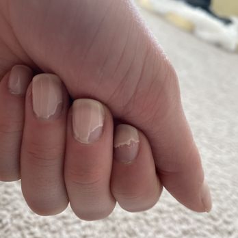 Awesome Nails & Spa - After 5 days started to peel. - Nail Salons Near Me - Marysville, Washington Awesome Nails & Spa - After 5 days started to peel. - Nail Salons Near Me - Marysville, Washington