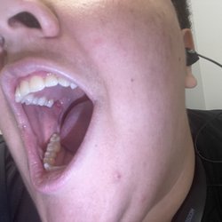 Tend Dental Ponce City Market - Dental trauma experienced
