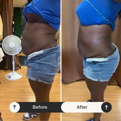 Relax By Nae - Body sculpting
Cavitation + RF Vacuum Therapy lymphatic rub