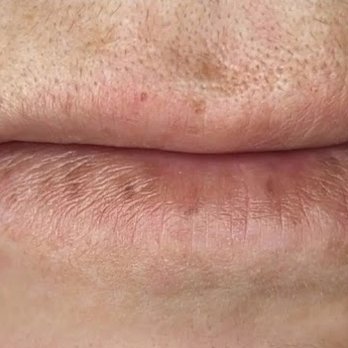 Accent On Faces - Lips before procedure - Permanent Makeup Near Me - Denver, Colorado