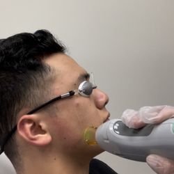 Laser Skin Hydration Spa - Laser hair removal face
