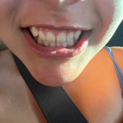 Bock Orthodontics - A human before braces