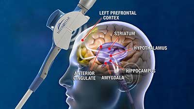 Prime Behavioral Health