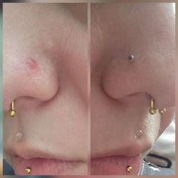 Wildside Tattoo - Both done 2 days apart, had to remove the one done by wildside because of the bump pictured. The right was Body Piercings by Jackie.