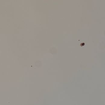 Tru by Hilton Gilbert - The questionable bloody snot splatter all over the ceiling/walls/curtains - Hotels Near Me - Gilbert, Arizona Tru by Hilton Gilbert - The questionable bloody snot splatter all over the ceiling/walls/curtains - Hotels Near Me - Gilbert, Arizona