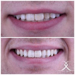 Lasting Impressions Dental Spa