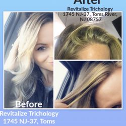 Revitalize Trichology Center - Before entering this business and interesting after result.