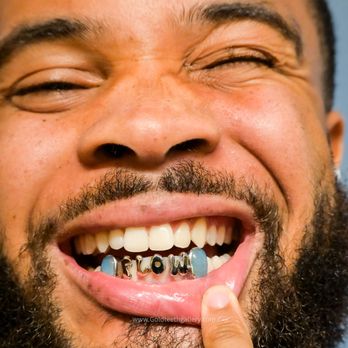 Gold Teeth Gallery - Jewelry Near Me - Oakland, California Gold Teeth Gallery - Jewelry Near Me - Oakland, California