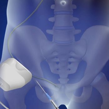 US Pain Clinic - Nerve block under ultrasound guidance - Pain Management Near Me - Glendale, California US Pain Clinic - Nerve block under ultrasound guidance - Pain Management Near Me - Glendale, California