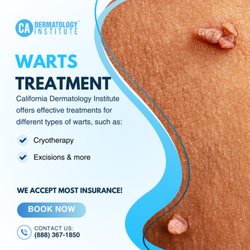 California Dermatology Institute - Contact us to learn more about warts treatment.