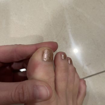Babylon Nails & Spa - Chipped polish (gel) before I even left to bottom left toenail - Nail Salons Near Me - Rancho Cucamonga, California Babylon Nails & Spa - Chipped polish (gel) before I even left to bottom left toenail - Nail Salons Near Me - Rancho Cucamonga, California