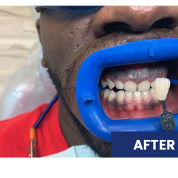 A+ Star Smile Dental - Endodontists Near Me - Houston, Texas A+ Star Smile Dental - Endodontists Near Me - Houston, Texas