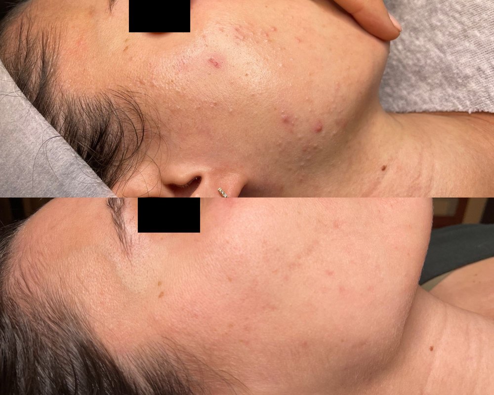 Healing Nature Skincare Logo