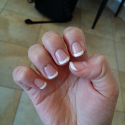 You can see the uneven lines on my fourth finger - NOT happy. You can see the uneven lines on my fourth finger - NOT happy.