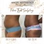 Photo of Angel Aesthetics Med spa