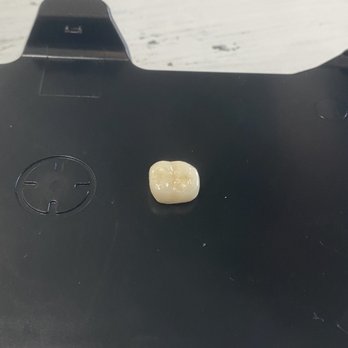Bacon Bitch - Broken tooth from eating hard biscuits - Breakfast & Brunch Near Me - Miami, Florida Bacon Bitch - Broken tooth from eating hard biscuits - Breakfast & Brunch Near Me - Miami, Florida