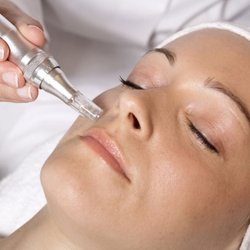 Beyond Beauty Pros - Microneedling