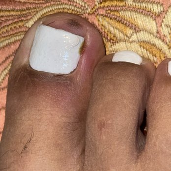 AStudio Nails - Horrible experience, as you can see I went there for a pedicure and what I received is an INFECTION back in my thumb . - Nail Technicians Near Me - Woodland Hills, California AStudio Nails - Horrible experience, as you can see I went there for a pedicure and what I received is an INFECTION back in my thumb . - Nail Technicians Near Me - Woodland Hills, California