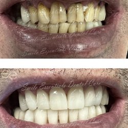 Smile Essentials Dental Care