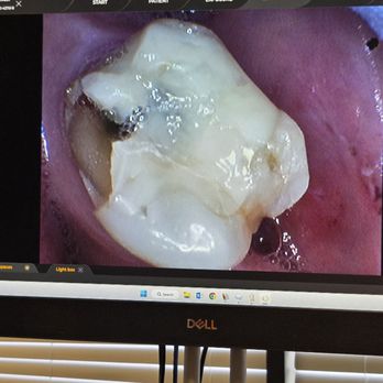 Del Mar Dental Studio - Before - Cosmetic Dentists Near Me - Del Mar, California Del Mar Dental Studio - Before - Cosmetic Dentists Near Me - Del Mar, California