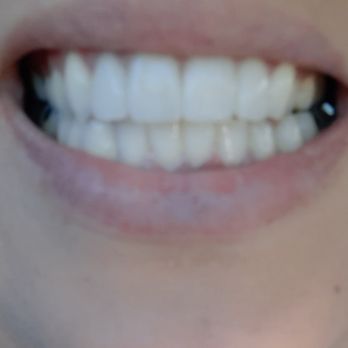 Accelerated Dental - General Dentistry Near Me - Las Vegas, Nevada Accelerated Dental - General Dentistry Near Me - Las Vegas, Nevada