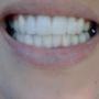 Accelerated Dental