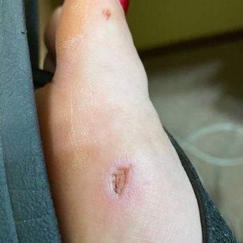 Good Nails - 5 days after the pedicure - Nail Salons Near Me - Benicia, California