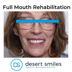 Desert Smiles Cosmetic and Restorative Dentistry - This was a great case with an even better person. Happy to help our patients achieve health beautiful smiles!