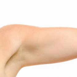 Tomball Electrolysis - Arms, arm pits