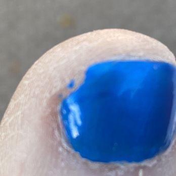 Anthem Nails & Spa - 2nd Large Toe Crackec - Nail Salons Near Me - Phoenix, Arizona