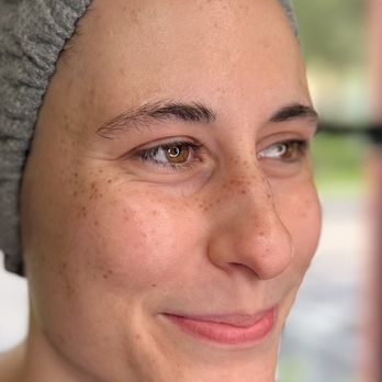The Micro Clinics - Freckle Tattoo - Permanent Makeup Near Me - Orlando, Florida The Micro Clinics - Freckle Tattoo - Permanent Makeup Near Me - Orlando, Florida