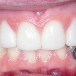 Tolman Dentistry: Nathan A.Tolman, DMD