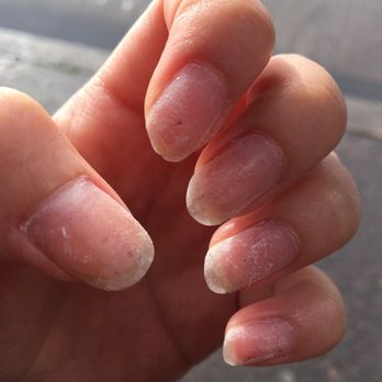 Mini Nails - Gel nail -off. " horrible " - Nail Salons Near Me - Eugene, Oregon