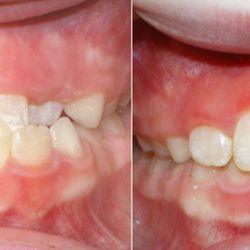 Allegany Orthodontics