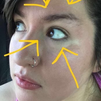 Love to Wax! - Before Love to Wax! Bad brows and yucky skin. - Skin Care Near Me - Las Vegas, Nevada Love to Wax! - Before Love to Wax! Bad brows and yucky skin. - Skin Care Near Me - Las Vegas, Nevada