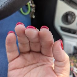 B B Nails - Glue and residue under nails and on skin.