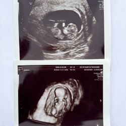 See My Baby Ultrasound
