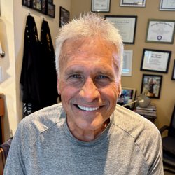 After Non-surgical Hair Replacement