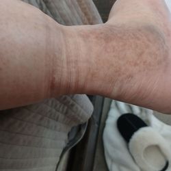 Bay Area Foot Care - Anvle