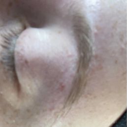Eyebrow Waxing Eyebrow Waxing