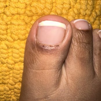 Fairy Nails Lounge - They cut my toe so bad it hurt for weeks! - Eyebrow Services Near Me - Hayward, California Fairy Nails Lounge - They cut my toe so bad it hurt for weeks! - Eyebrow Services Near Me - Hayward, California