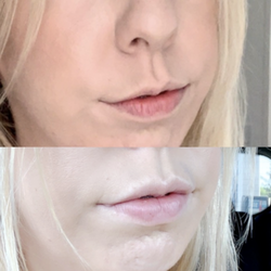Ideal Image Novi - Work done by Meagan