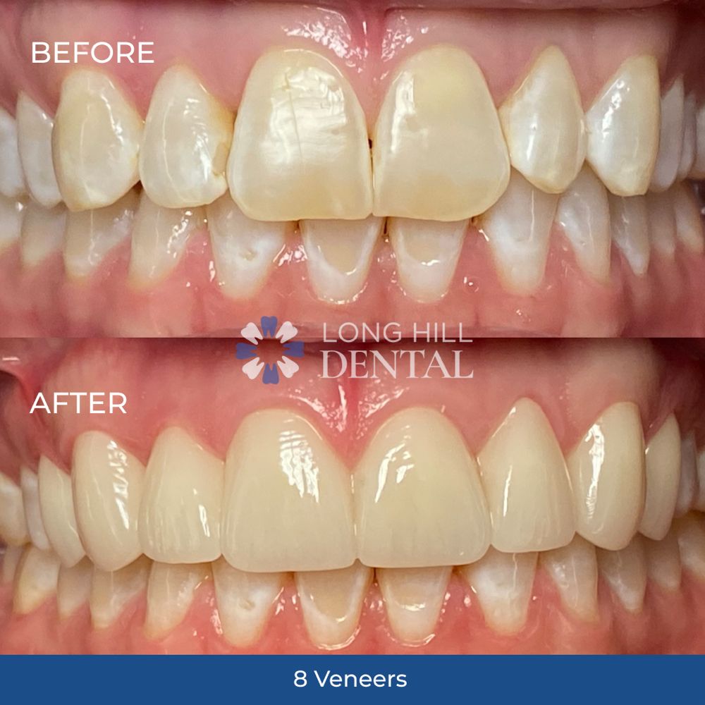 LONG HILL DENTAL Updated October 2024 671 Valley Rd, Gillette, New