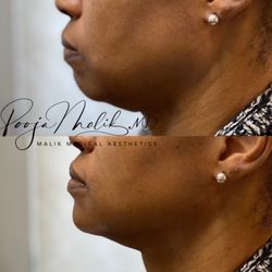 Malik Medical Aesthetics
